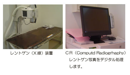 レントゲン（Ｘ線）装置